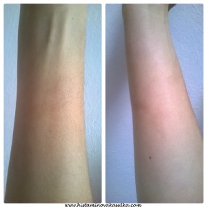 3 dny po 2.biorezonanci