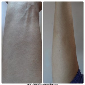 3tydny po 2 biorezonanci