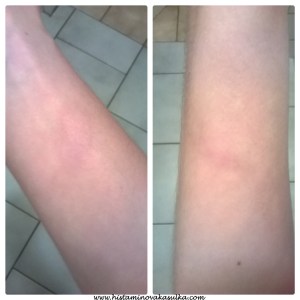 v den 2.biorezonance